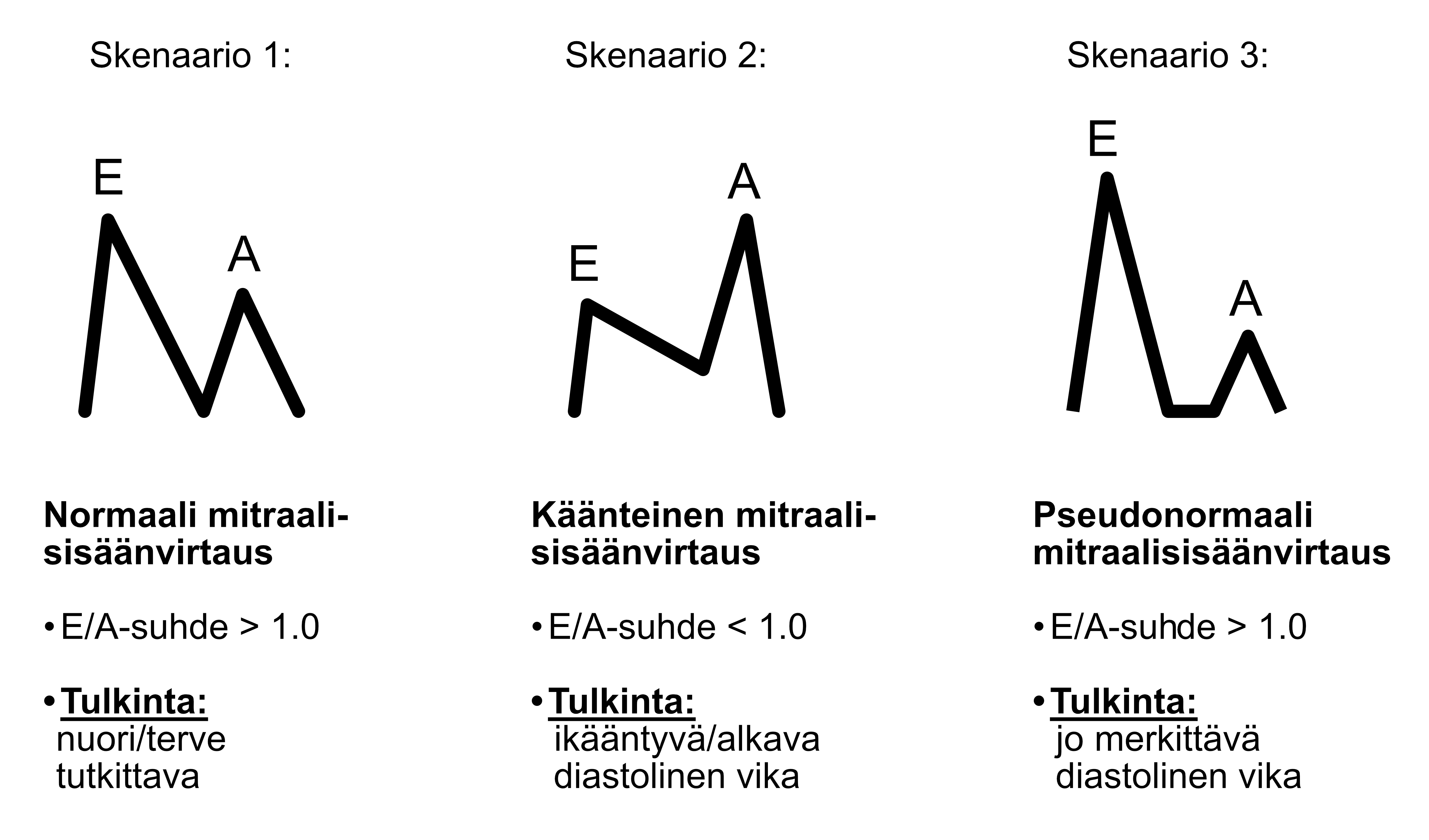 Different scenarios of mitral inflow.
