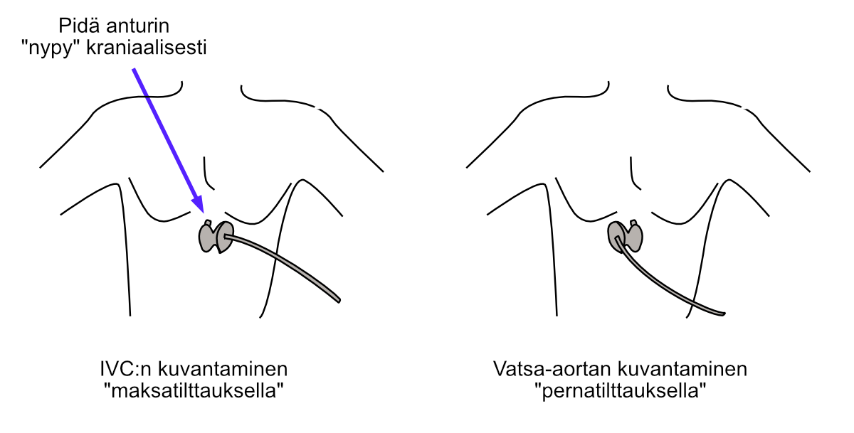 Identification of inferior vena cava and abdominal aorta using “liver and spleen tilting”.
