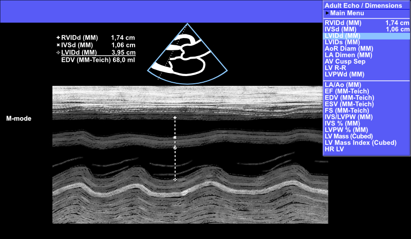 Left ventricular diastolic diameter (LVIDd) measurement using M-mode.