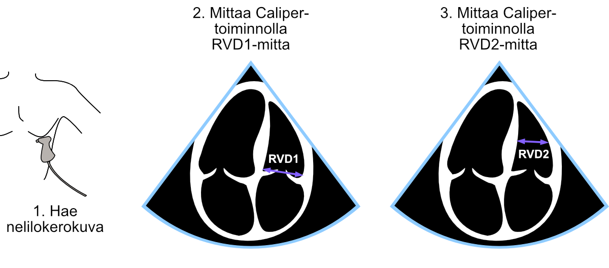 Performance of RVD1 and RVD2 measurements.